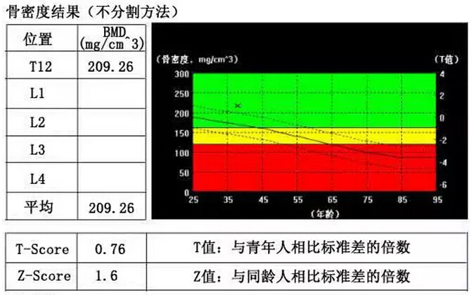 骨密度是怎么一回事