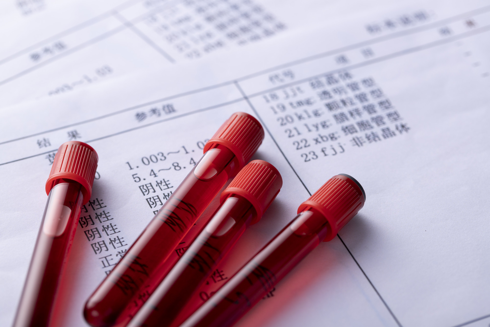 体检抽了很多血有影响吗抽血化验能查出什么